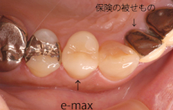 e-max02