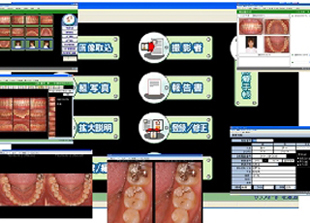 画像管理ソフト