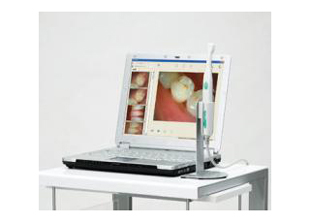 コンパクト口腔内カメラ