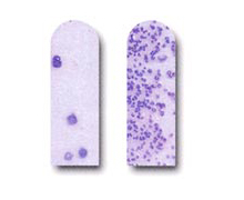 カリエスリスク（だ液）検査