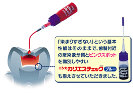 カリエスチェック